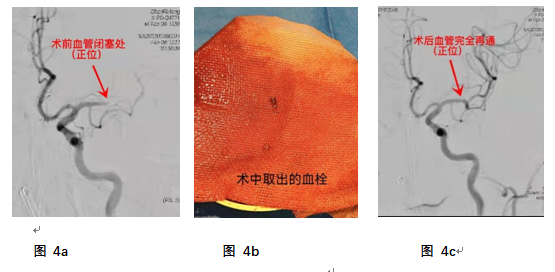 1646299490522957.png image.png